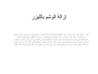 إزالة الوشم بالليزر