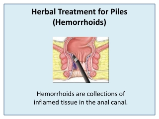 Reduce Pain and Bleeding of Piles with Pilepsole Capsule
