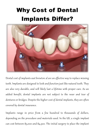 Why Cost of Dental Implants Differ