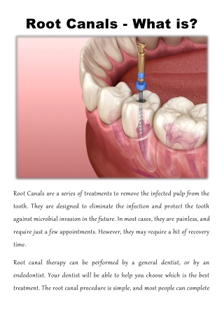 Root Canals - What is?