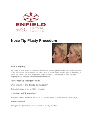 Nose Tip Plasty Procedure