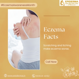 Eczema Facts | Best Skin Clinic in Jayanagar | Epiderma Clinic