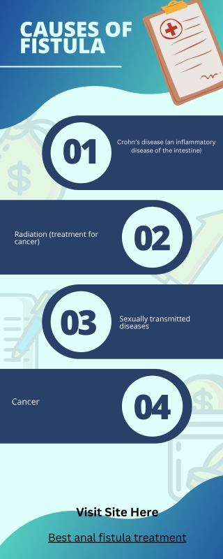 Best anal fistula treatment