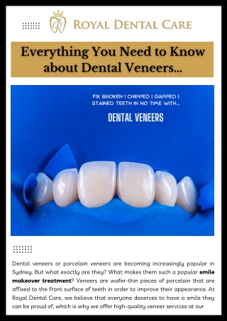 Everything you need to know about Dental Veneers