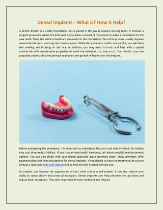 Dental Implants - What is? How it Help?