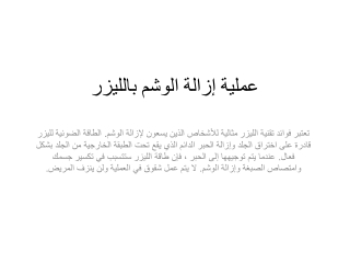 عملية إزالة الوشم بالليزر