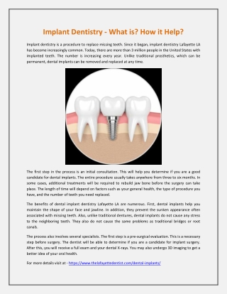 Implant Dentistry - What is? How it Help?