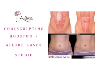 Coolsculpting Houston - ALLURE LASER STUDIO