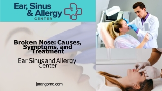 Broken Nose Causes, Symptoms, and Treatment - Ear Sinus and Allergy Center