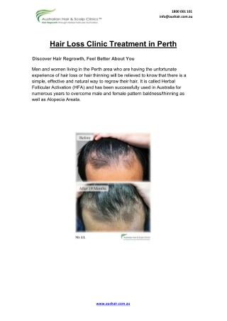 Hair Loss Clinic Treatment in Perth