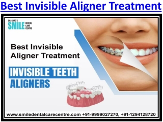 Best Invisible Aligner Treatment in Faridabad - Orthodontic Dental Clinic