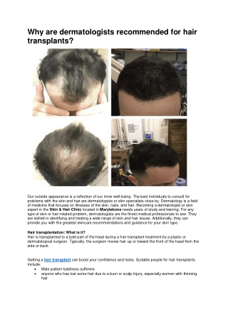 Best Hair Loss Clinic in Soho