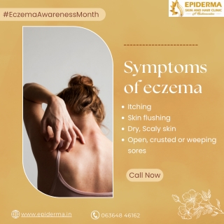 Symptoms of Eczema | Best Skin Clinic in Jayanagar | Epiderma Clinic