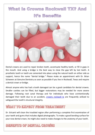 What Is Crowns Rockwall TX? And It’s Benefits