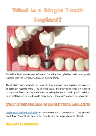 What is a Single Tooth Implant