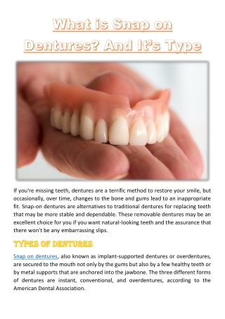 What is Snap on Dentures? And It’s Type