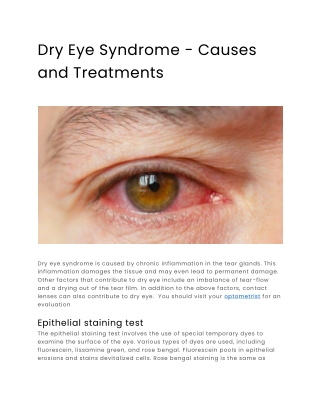 Dry Eye Syndrome - Causes and Treatments