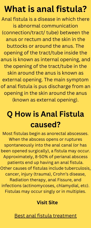 Best anal fistula treatment