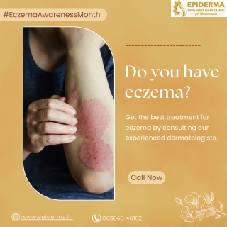 Do you have eczema | Best Skin Clinic in Jayanagar, Bangalore | Epiderma Clinic