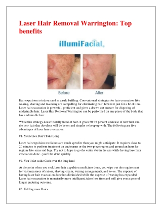Get The Best Skin Rejuvenation in Warrington.