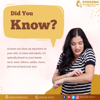 Know about Eczema | Best Dermatologist in Jayanagar, Bangalore | Epiderma Clinic