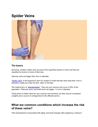 Spider Veins