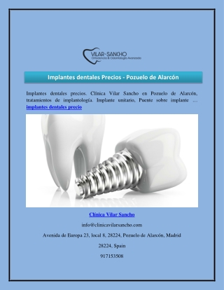 Implantes dentales Precios - Pozuelo de Alarcón