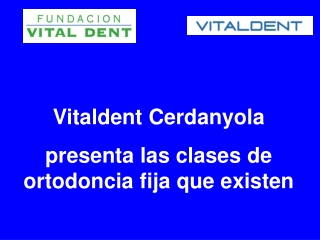 Vitaldent Cerdanyola presenta variedades de ortodoncia fija