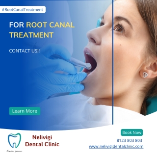 Rootcanal Treatment - Best Dental Clinic in Bellandur - Nelivigi Dental Clinic