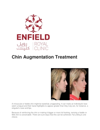 Chin Augmentation in Dubai