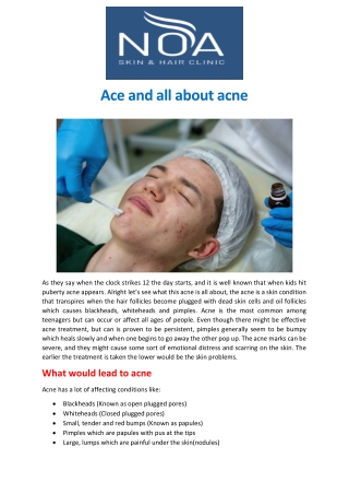 Ace and all about acne