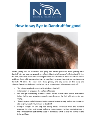 How to say Bye to Dandruff for good