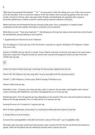 The History of 샌즈카지노