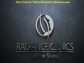 How to Select the Best Clinic for Tattoo Removal in Bhubaneswar