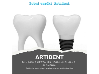 Zobni vsadki Artident