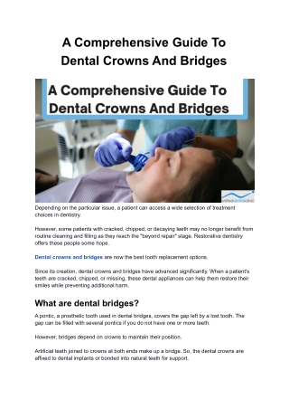 A Comprehensive Guide To Dental Crowns And Bridges