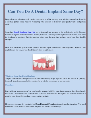 Can You Do A Dental Implant Same Day?