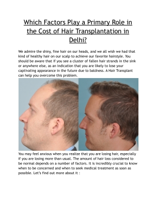 Which Factors Play a Primary Role in the Cost of Hair Transplantation in Delhi_