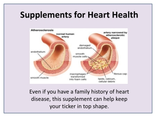 Maintaining Good Cardiovascular Health