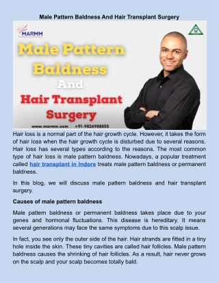 _Male Pattern Baldness And Hair Transplant Surgery .docx