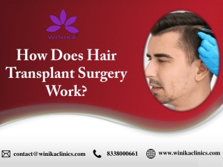 How Does Hair Transplant Surgery Work