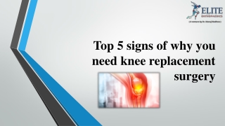 Top 5 signs of why you need knee replacement surgery