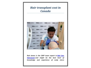 Hair transplant cost in Canada