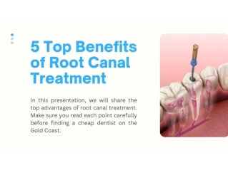 5 Top Benefits of Root Canal Treatment