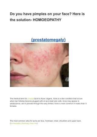 Do you have pimples on your face? Here is the solution- HOMOEOPATHY