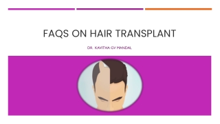 FAQs on Hair Transplant | Hair Transplant in Sarjapur Road at SK Truderma