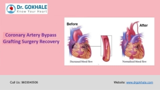 Coronary Artery Bypass Grafting Surgery Recovery | Dr Gokhale