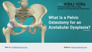 What Is a Pelvic Osteotomy for an Acetabular Dysplasia | Dr Niraj Vora