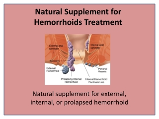 Herbal Treatment for Hemorrhoids and Bleeding Piles