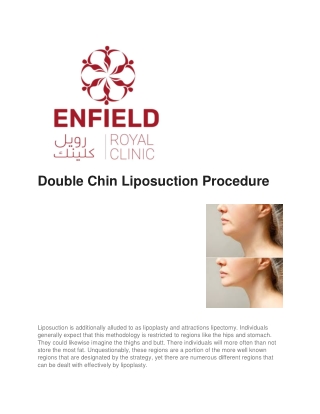 Double Chin Liposuction in Dubai